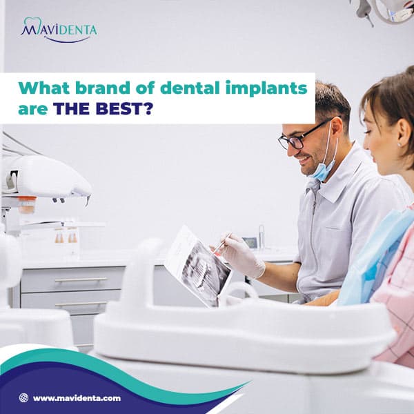 Best Rated Dental Implants: A Comprehensive Guide best rated dental implants