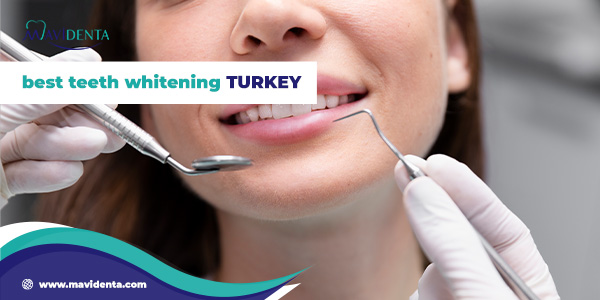 best teeth whitening turkey
