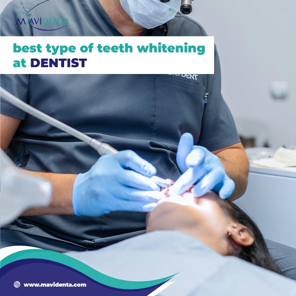 Best Teeth Whitening Turkey: Guide to In-Office Treatments best teeth whitening turkey