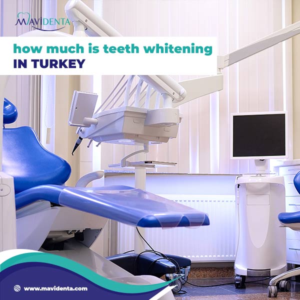 Teeth Whitening Turkey Price | Shine Brighter for Less teeth whitening turkey price