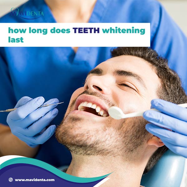 Teeth Whitening Turkey Price | Shine Brighter for Less teeth whitening turkey price