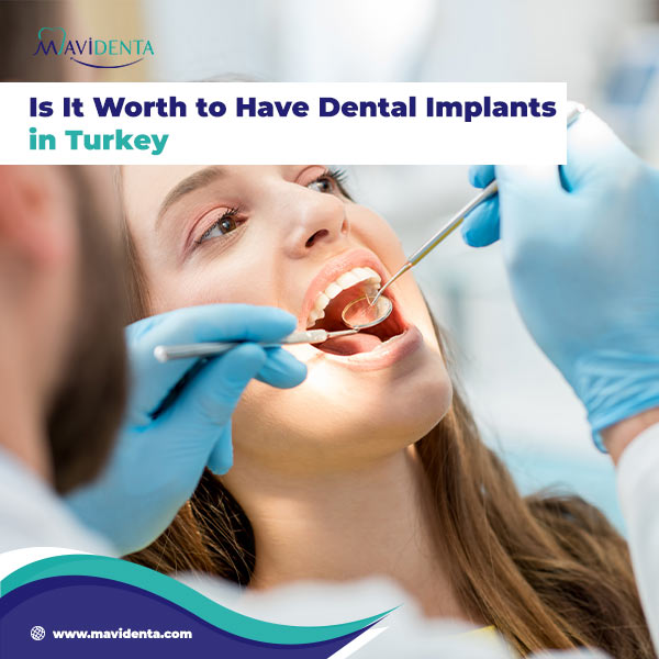 What Is The Best Place To Have Dental Implants? best place to have dental implants
