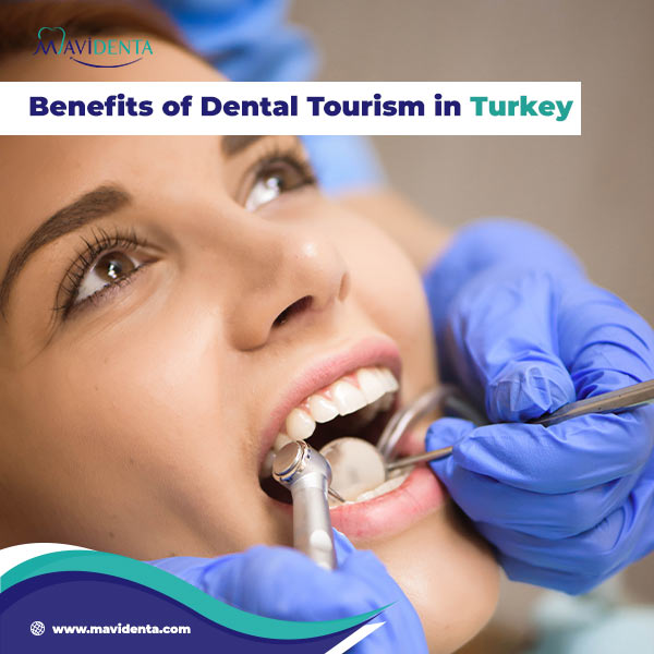 What Is The Best Place To Have Dental Implants? Best Place To Have Dental Implants