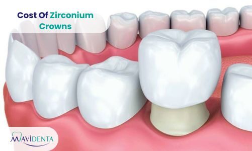 Cost Of Zirconium Crown
