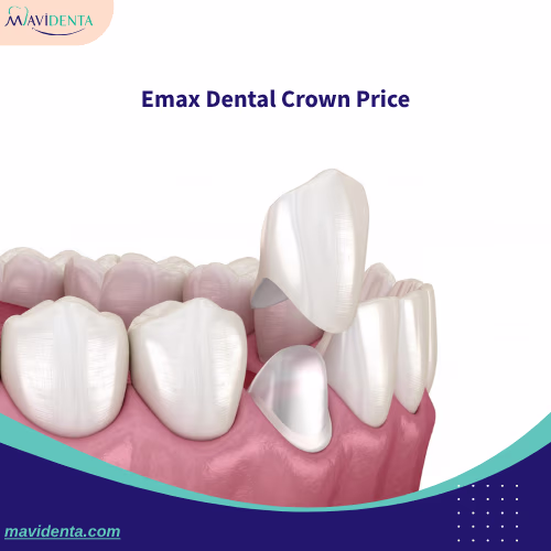 Emax Dental Crown Price Emax Dental Crown Price
