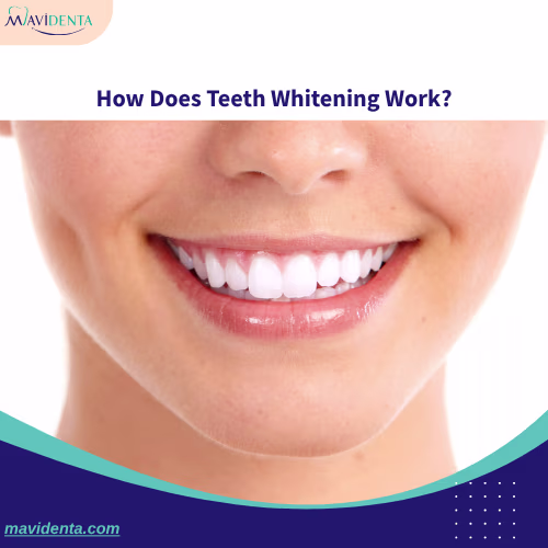 Average Cost Of Teeth Whitening How Does Teeth Whitening Work