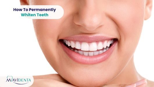 How To Permanently Whiten Teeth