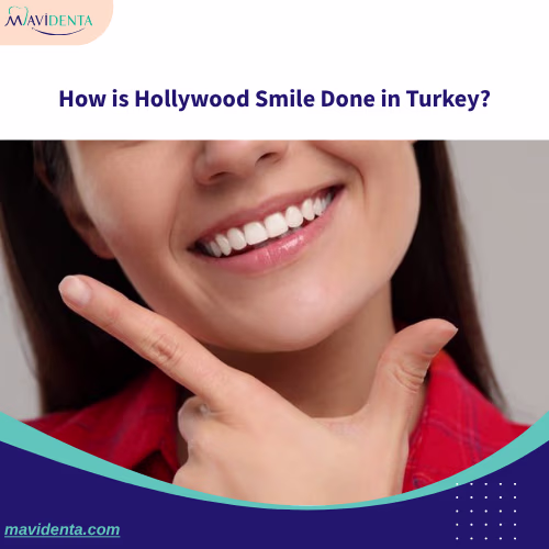 Best Clinic For Hollywood Smile In Turkey How is Hollywood Smile Done in Turkey