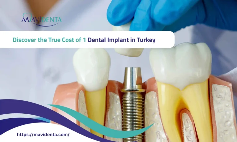 cost of 1 dental implant