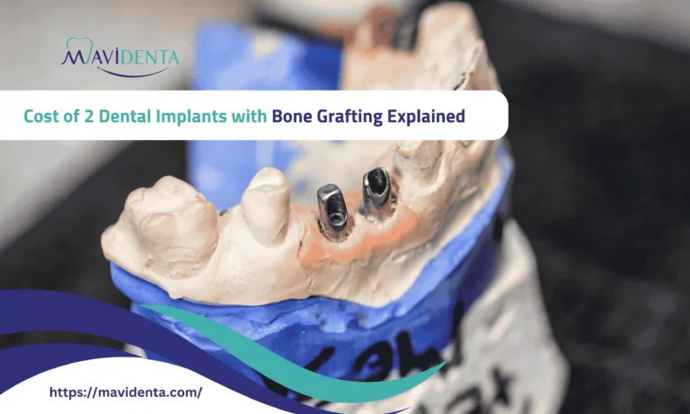 cost of 2 dental implants with bone grafting