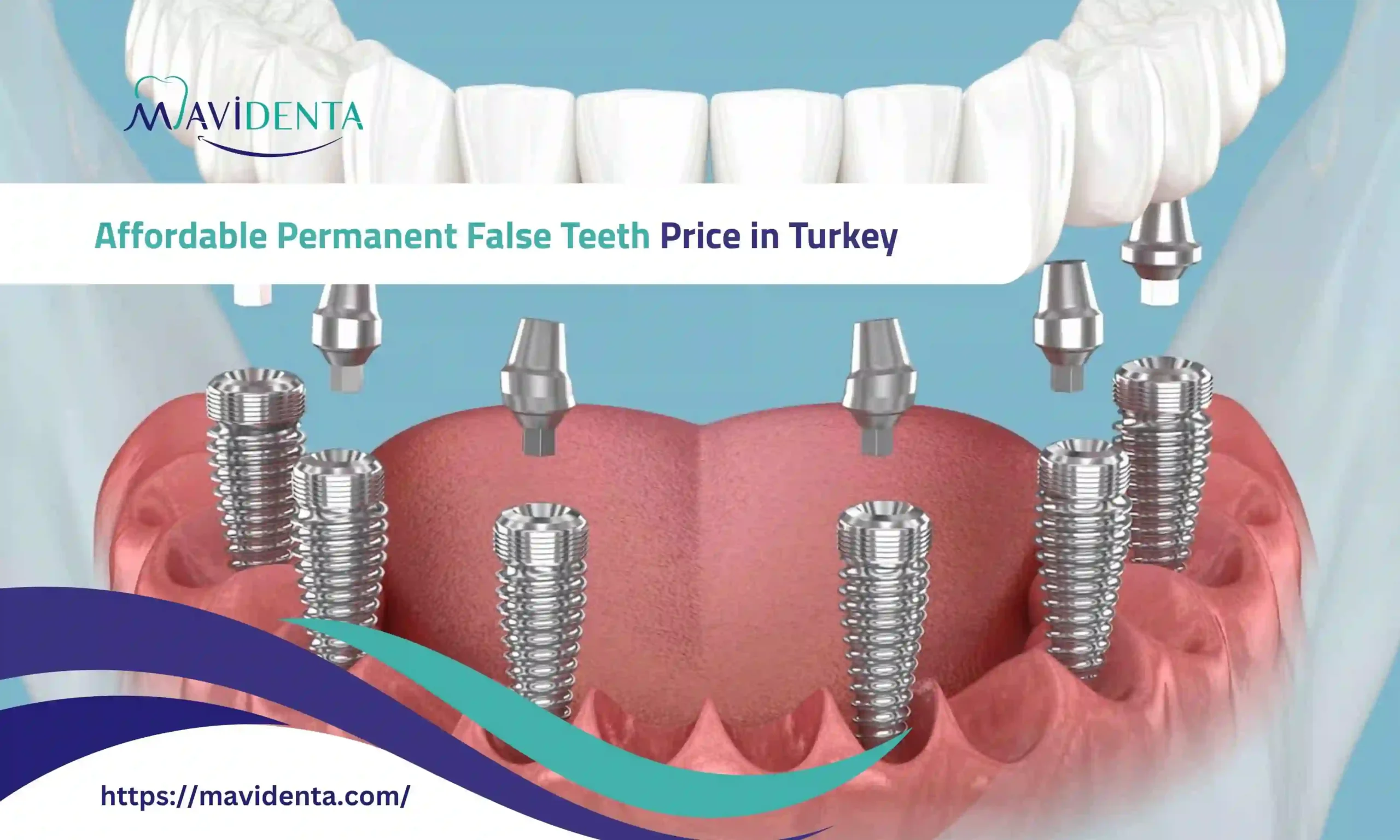 permanent false teeth price