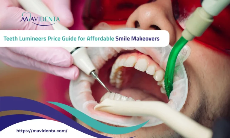 teeth lumineers price