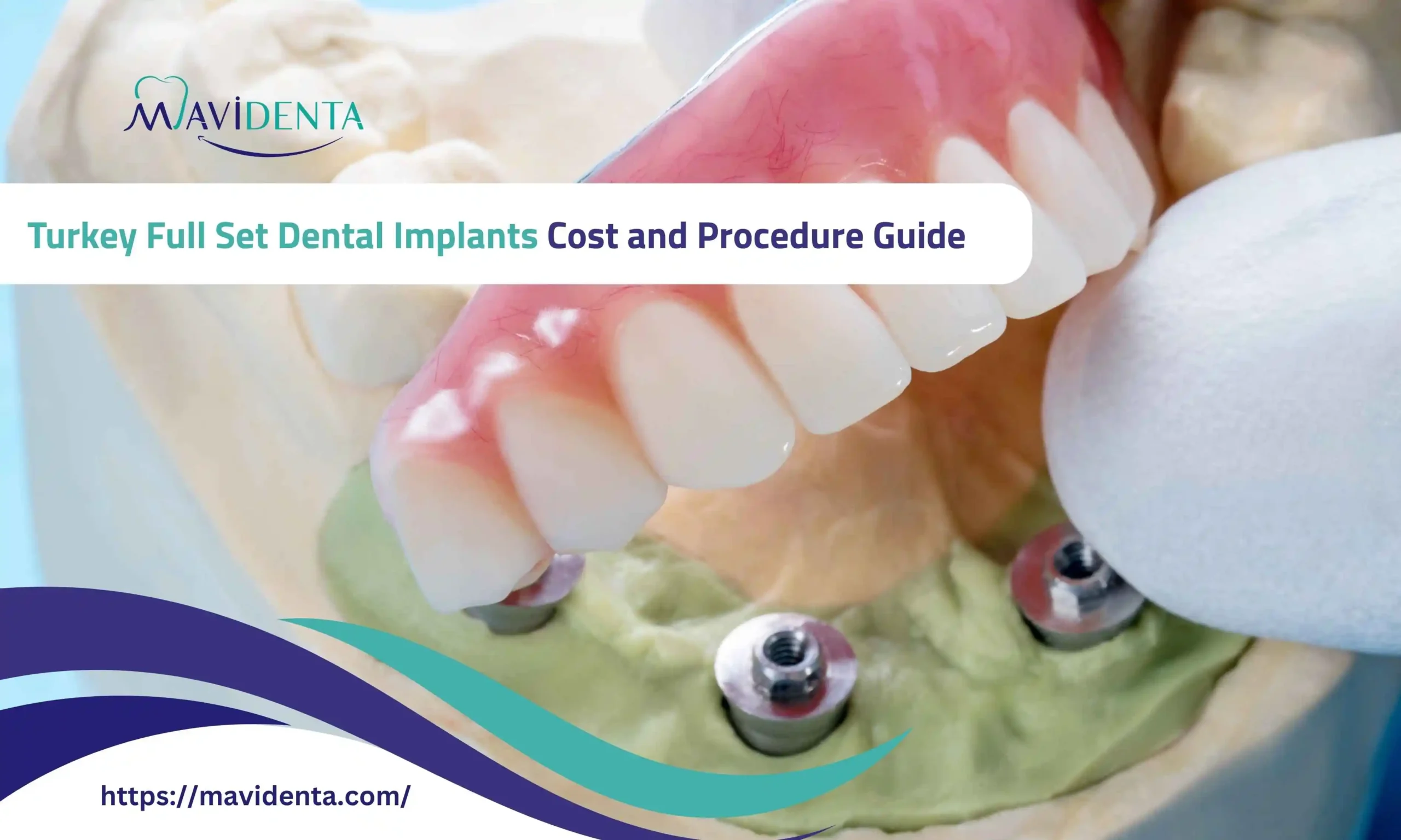 turkey full set dental implants